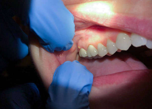 Best Emergency Dental Surgery in Rendon, TX