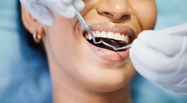 Best Emergency Tooth Extraction in Rendon, TX
